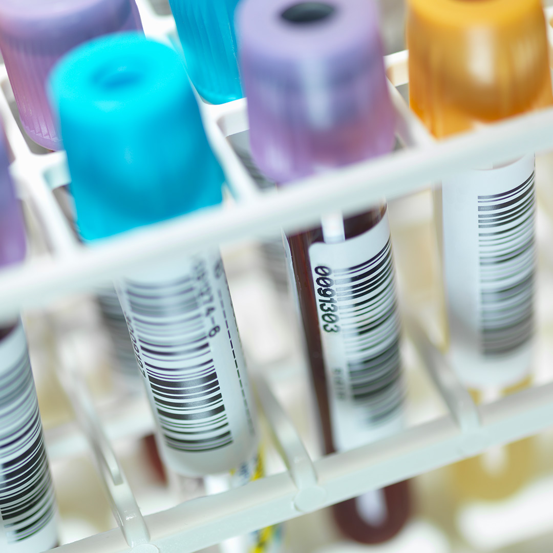 Close-up of labeled blood sample tubes with colored caps and barcodes organized in a white rack for identification.